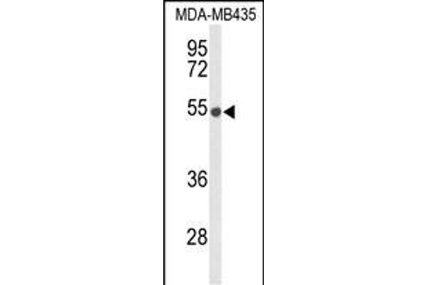 DMC1 antibody  (N-Term)
