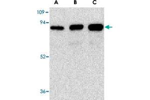 Western blot analysis of (A) 25 ng, (B) 50 ng, and (C) 100 ng of purified recombinant NGFR with NGFR polyclonal antibody  at 1 ug/mL . (NGFR Antikörper)