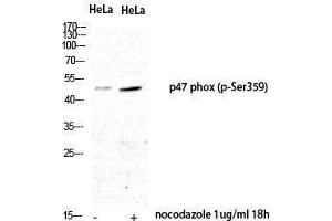 Western Blotting (WB) image for anti-Neutrophil Cytosol Factor 1 (NCF1) (pSer359) antibody (ABIN3182821) (NCF1 Antikörper  (pSer359))