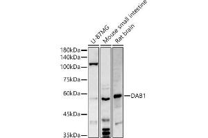 Western blot analysis of extracts of various cell lines, using D antibody (ABIN6130320, ABIN6139385, ABIN6139386 and ABIN6214572) at 1:500 dilution. (DAB1 Antikörper  (AA 1-185))