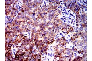 Immunohistochemistry (IHC) image for anti-Protein Phosphatase 2A Activator, Regulatory Subunit 4 (PPP2R4) antibody (ABIN1108715) (PPP2R4 Antikörper)