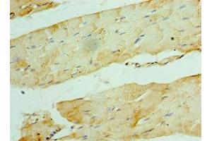 Immunohistochemistry of paraffin-embedded human skeletal muscle tissue using ABIN7175850 at dilution of 1:100