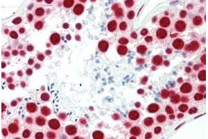 Human Testis: Formalin-Fixed, Paraffin-Embedded (FFPE)