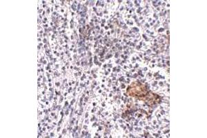 Immunohistochemistry (IHC) image for anti-Leucine-rich repeat protein SHOC-2 (SHOC2) (N-Term) antibody (ABIN1031560) (SHoc2/Sur8 Antikörper  (N-Term))