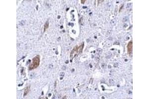 Immunohistochemistry of ATOH8 in mouse brain tissue with this product atOH8 antibody at 5 μg/ml. (ATOH8 Antikörper  (C-Term))