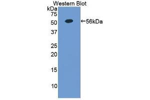Western Blotting (WB) image for anti-Erythropoietin Receptor (EPOR) (AA 276-496) antibody (ABIN1858733) (EPOR Antikörper  (AA 276-496))