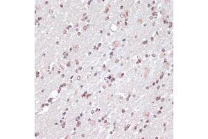 Immunohistochemistry of paraffin-embedded rat brain using c-Jun antibody (ABIN6131074, ABIN6142670, ABIN6142671 and ABIN6215187) at dilution of 1:100 (40x lens). (C-JUN Antikörper  (AA 1-70))