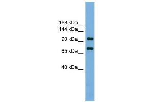 WB Suggested Anti-Ttf1 Antibody Titration: 0. (TTF1 Antikörper  (N-Term))
