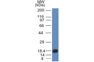 Image no. 1 for anti-Mast/stem Cell Growth Factor Receptor (KIT) (AA 100-300) antibody (ABIN6190789) (KIT Antikörper  (AA 100-300))