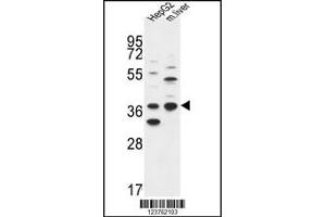 Western blot analysis in HepG2 cell line and mouse liver tissue lysates (35ug/lane).