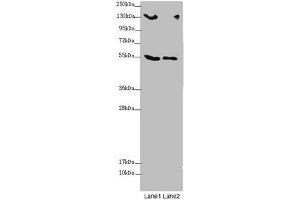 Western blot All lanes: CSPP1 antibody at 1. (CSPP1 Antikörper  (AA 997-1256))