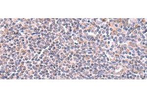 Immunohistochemistry of paraffin-embedded Human tonsil tissue using GMDS Polyclonal Antibody at dilution of 1:70(x200) (GMDS Antikörper)