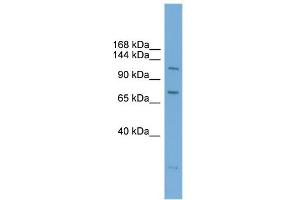 WB Suggested Anti-PAntibody Titration:  0. (PARP10 Antikörper  (N-Term))