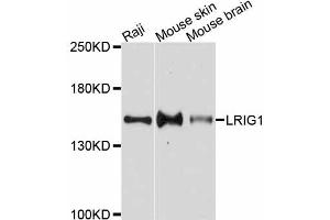 Western blot analysis of extracts of various cell lines, using LRIG1 antibody. (Lrig1 Antikörper)