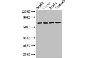 Western Blot Positive WB detected in: HepG2 whole cell lysate, Rat liver tissue, Rat brain tissue, Rat stomach tissue All lanes: RCBTB2 antibody at 3. (RCBTB2 Antikörper  (AA 1-200))
