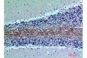 Immunohistochemistry (IHC) analysis of paraffin-embedded Human Brain, antibody was diluted at 1:200.