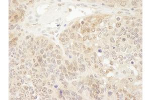 Immunohistochemistry (IHC) image for anti-Parkinson Protein 7 (PARK7) (C-Term) antibody (ABIN7448532)
