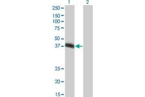 Western Blot analysis of HLF expression in transfected 293T cell line by HLF monoclonal antibody (M03), clone M1. (HLF Antikörper  (AA 1-295))