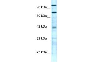 WB Suggested Anti-ZNF23 Antibody Titration:  0. (ZNF23 Antikörper  (N-Term))