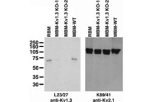 Immunoblot on adult rat brain membranes (RBM), and adult mouse brain membranes from two Kv1.