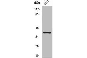 Western Blot analysis of K562 cells using ZNF134 Polyclonal Antibody (ZNF134 Antikörper  (Internal Region))