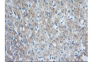 Immunohistochemical staining of paraffin-embedded Human liver tissue using anti-HIBCH mouse monoclonal antibody. (HIBCH Antikörper)