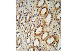 CYP27B1 Antibody (C-term) B immunohistochemistry analysis in formalin fixed and paraffin embedded human kidney tissue followed by peroxidase conjugation of the secondary antibody and DAB staining.