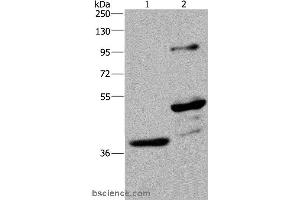 Western blot analysis of Human fetal brain and mouse brain tissue, using GAS7 Polyclonal Antibody at dilution of 1:625 (GAS7 Antikörper)