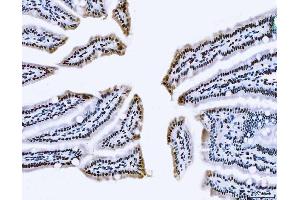 IHC analysis of TLS/FUS using anti-TLS/FUS antibody (ABIN7603099).