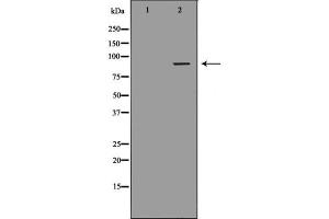 Western blot analysis of extracts from Jurkat cells, using DVL2 antibody. (DVL2 Antikörper  (C-Term))