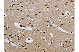 The image on the left is immunohistochemistry of paraffin-embedded Human brain tissue using ABIN7190315(CMTM8 Antibody) at dilution 1/40, on the right is treated with synthetic peptide.