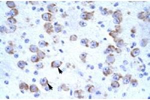 Immunohistochemical staining (Formalin-fixed paraffin-embedded sections) of human brain with CATSPER2 polyclonal antibody  at 4-8 ug/mL working concentration. (CATSPER2 Antikörper  (N-Term))