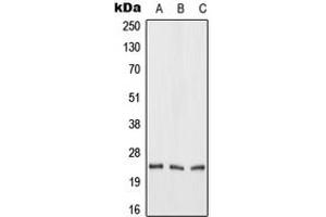 Western blot analysis of FGF19 expression in HeLa (A), mouse liver (B), rat liver (C) whole cell lysates.
