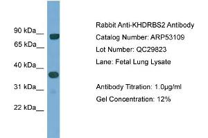 WB Suggested Anti-KHDRBS2  Antibody Titration: 0. (KHDRBS2 Antikörper  (N-Term))
