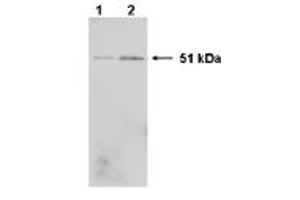 Western Blotting (WB) image for anti-Heterogeneous Nuclear Ribonucleoprotein K (HNRNPK) (C-Term) antibody (ABIN264512) (HNRNPK Antikörper  (C-Term))