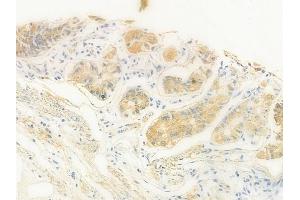 ABIN6257187 and ABIN6273849 at 1/100 staining human normal gastric tissue by IHC-P.