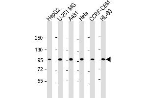 All lanes : Anti-TAF4 Antibody (C-Term) at 1:2000 dilution Lane 1: HepG2 whole cell lysate Lane 2: U-251 MG whole cell lysate Lane 3: A431 whole cell lysate Lane 4: Hela whole cell lysate Lane 5: CCRF-CEM whole cell lysate Lane 6: HL-60 whole cell lysate Lysates/proteins at 20 μg per lane. (TAF4 Antikörper  (AA 1021-1062))