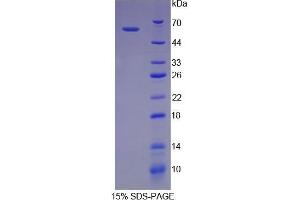 SDS-PAGE (SDS) image for Ribophorin 1 (RPN1) (AA 273-518) protein (His tag,GST tag) (ABIN2123562)