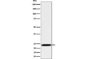 Western blot analysis of ARFRP1 / ARP expression in 293 cell lysate.