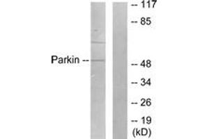 Western blot analysis of extracts from Jurkat cells, using Parkin Antibody.