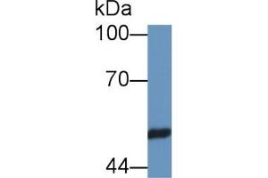 Detection of PSMC4 in Rat Testis lysate using Polyclonal Antibody to Proteasome 26S Subunit, ATPase 4 (PSMC4)