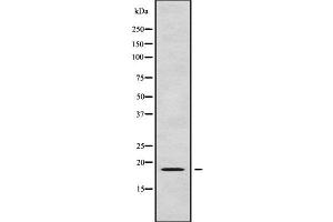 Western blot analysis of RPL24 using LOVO whole cell lysates (RPL24 Antikörper  (Internal Region))