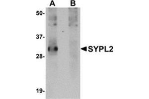 Western blot analysis of SYPL2 in human spleen tissue lysate with this product at 1 μg/ml in (A) the absence and (B) the presence of blocking peptide. (SYPL2 Antikörper  (C-Term))