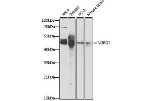 Western blot analysis of extracts of various cell lines, using NDRG1 antibody. (NDRG1 Antikörper  (AA 175-394))