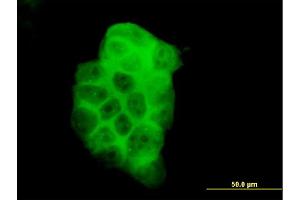 Immunofluorescence of monoclonal antibody to PIK3C2B on A-431 cell. (PIK3C2B Antikörper  (AA 1-110))