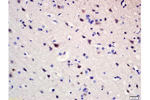 Formalin-fixed and paraffin embedded rat brain labeled with Rabbit Anti-Pumilio 1 Polyclonal Antibody, Unconjugated (ABIN1387238) at 1:200 followed by conjugation to the secondary antibody and DAB staining