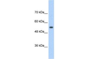 Western Blotting (WB) image for anti-Solute Carrier Family 13 Member 3 (SLC13A3) antibody (ABIN2462409) (SLC13A3 Antikörper)