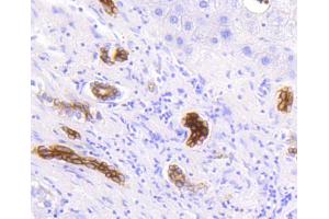 Paraformaldehyde-fixed, paraffin embedded Human liver, Antigen retrieval by boiling in sodium citrate buffer (pH6) for 15min, Block endogenous peroxidase by 3% hydrogen peroxide for 30 minutes, Blocking buffer at 37°C for 20min, Antibody incubation with Cytokeratin 19 (2F3) Monoclonal Antibody  at 1:50 overnight at 4°C, followed by a conjugated secondary and DAB staining. (Cytokeratin 19 Antikörper)