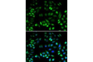 Immunofluorescence analysis of U2OS cells using MANF antibody. (MANF Antikörper  (AA 25-182))