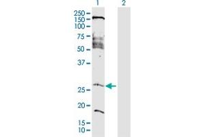 Western Blot analysis of FAM177A1 expression in transfected 293T cell line by FAM177A1 MaxPab polyclonal antibody. (FAM177A1 Antikörper  (AA 1-213))